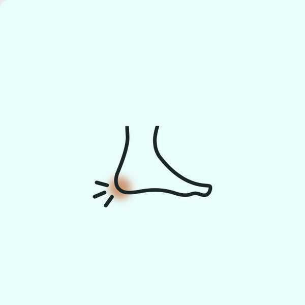 Plantarfasziitis