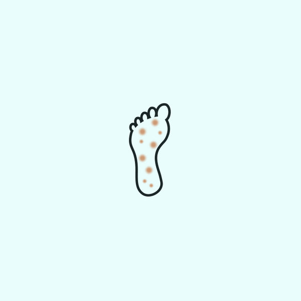 Neuropathie